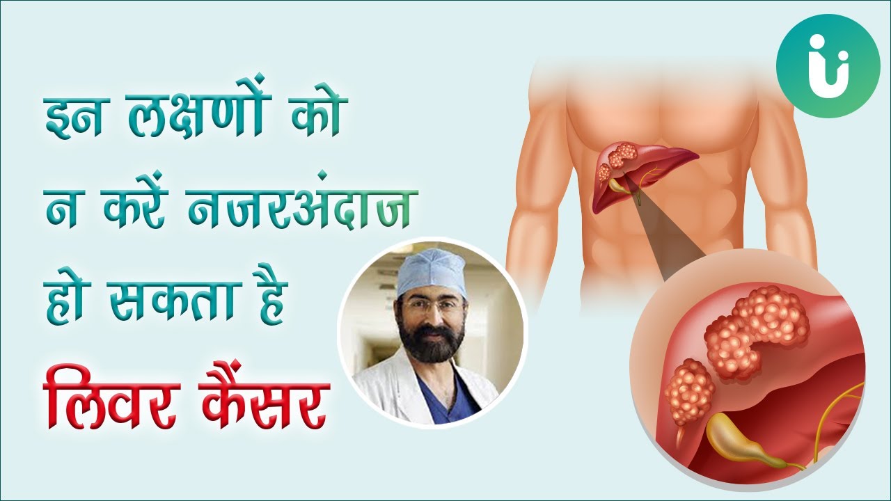 ये लक्षण दिखें तो हो सकता है लिवर कैंसर - डॉ सोइन से जानें लिवर कैंसर का कारण, इलाज और बचने के उपाय - YouTube