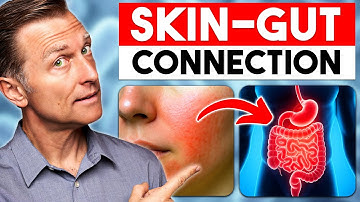Your Skin Is WARNING You (Don’t Ignore This!)