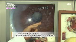 순간 포착 세상에 이런 일이 130718 #14(5)