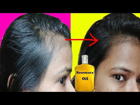 Best supplements for hair loss Apply rosemary oil for hair growth   Expresscouk