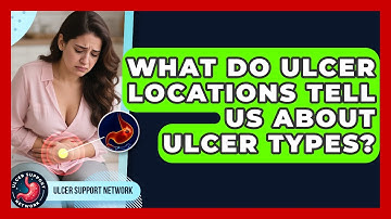 What Do Ulcer Locations Tell Us About Ulcer Types? - Ulcer Support Network