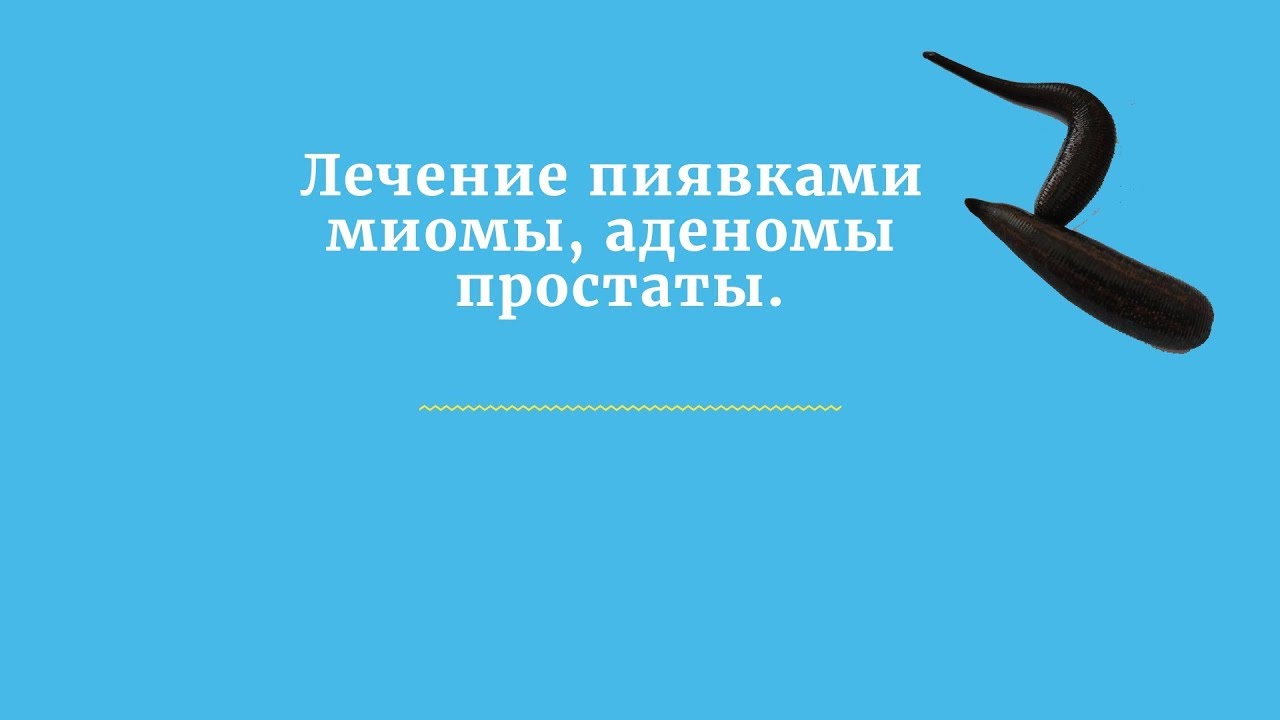 ⁣Лечение пиявками миомы, аденомы простаты.