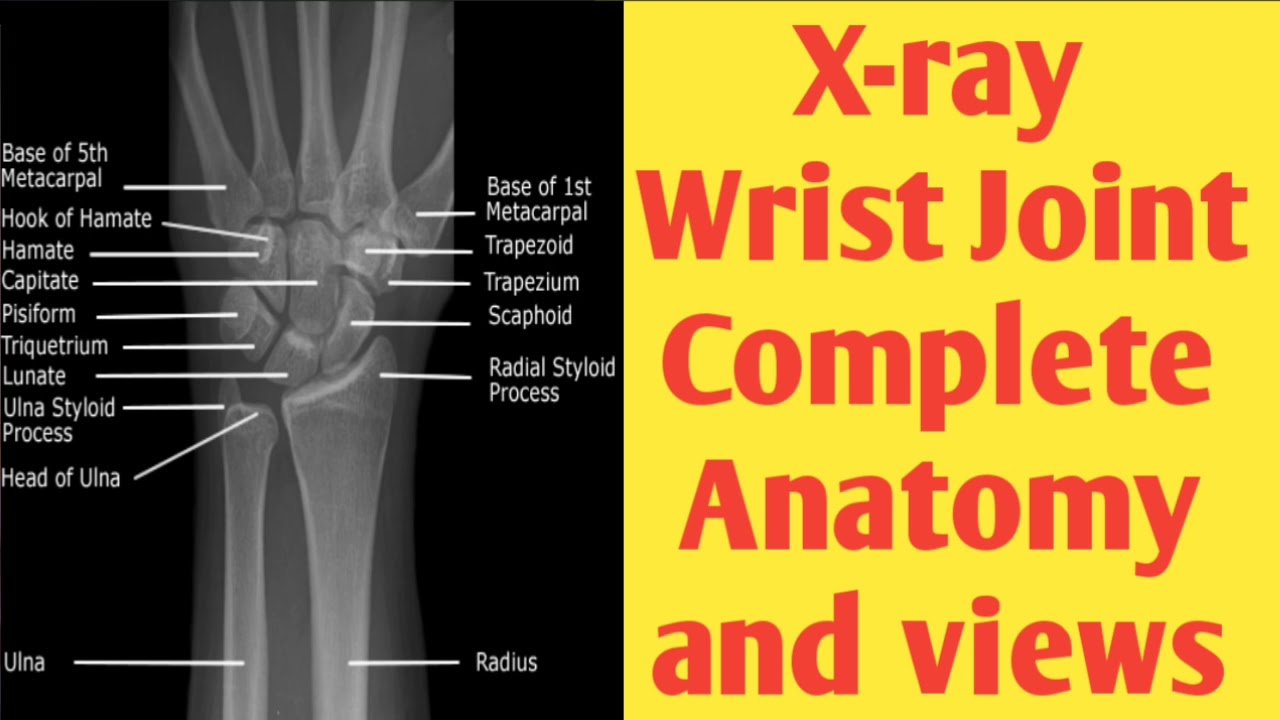 Wrist Anatomy X Ray Labeled