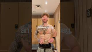 Sydney marathon training with an ostomy bag week 3 #adaptiveathlete #stoma #ostomy #crohnsdisease