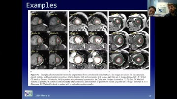 This is a recording of the Medis webinar about Medis Suite MR -New features in upcoming release 2018