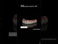 Its RR Dental lab- best dental lab in India