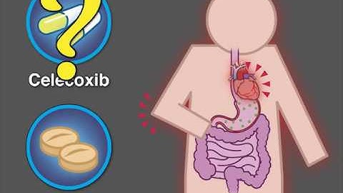 Quick Take: Cardiovascular Safety of Celecoxib