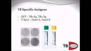 QFT and T SPOT TB Tests  What do the numbers mean?