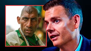 The Shocking Impact Cousin Marriage Deformities Have On The Nhs Matt Goodwin