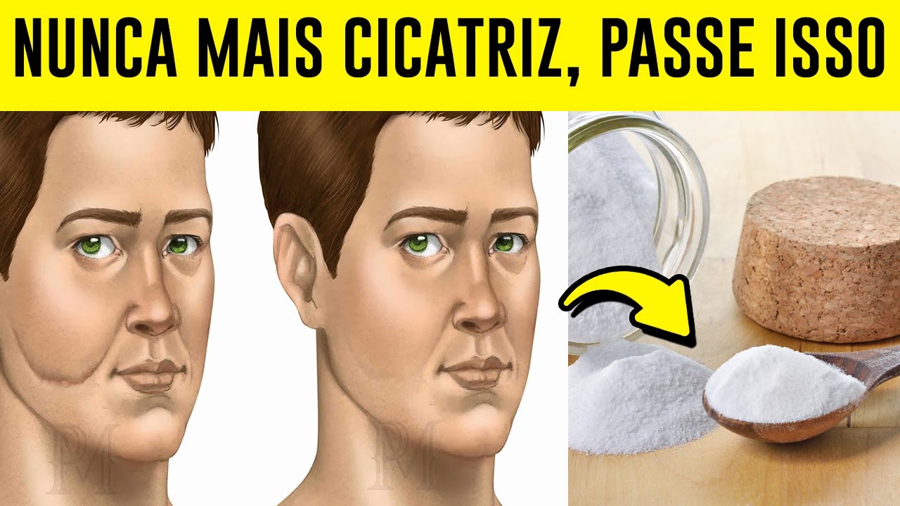 Remédio Caseiro Para Cicatrização - RETOEDU