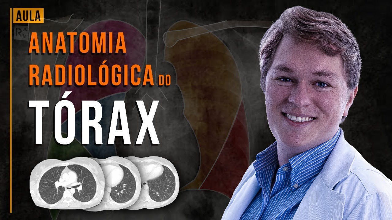 Anatomia Radiológica do tórax