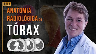 Anatomia Radiológica do tórax