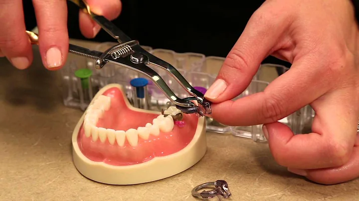 Triodent V4 ClearMetal Matrix System demonstration...