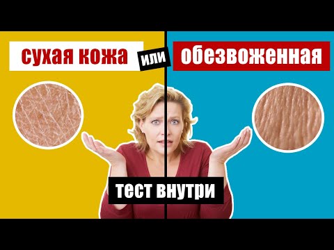 Сухая кожа - причины и правильный физиологический уход за кожей