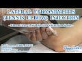 LATERAL EPICONDYLITIS (TENNIS ELBOW) INJECTION: Step-By-Step Teaching Simulation - YouTube LATERAL EPICONDYLITIS (TENNIS ELBOW) INJECTION: Step-By-Step Teaching Simulation - YouTube