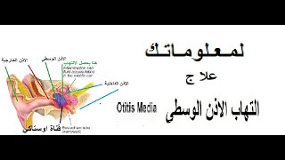 التهاب الاذن الوسطى و علاجه بالطب العربي