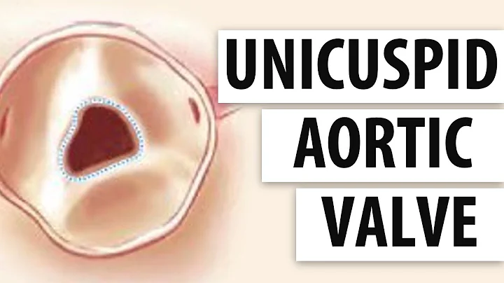 Unicuspid Aortic Valves: Top 5 Facts Patients Shou...
