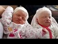 She gave birth to albino twins with white hair. Check out what they look like now..