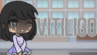 “Vitiligo “ // Gacha Life Mini Movie // GLMM // Blu Girl