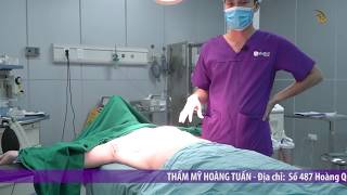 Livestream - Bác Sĩ Phân Tích Lâm Sàng Ca Ngực Lép Trước Phẫu Thuật