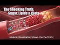 I Wish I Knew This Earlier! The Shocking Link Between Blood Sugar, Lipids, and Blood Clots!