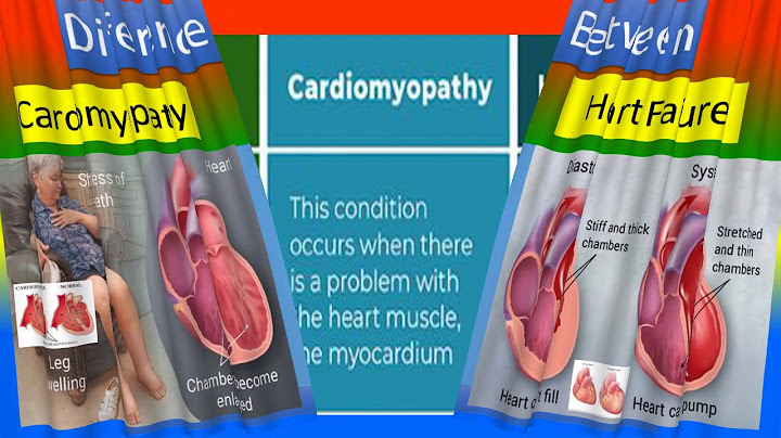 What is the difference between cardiomyopathy and congestive heart failure