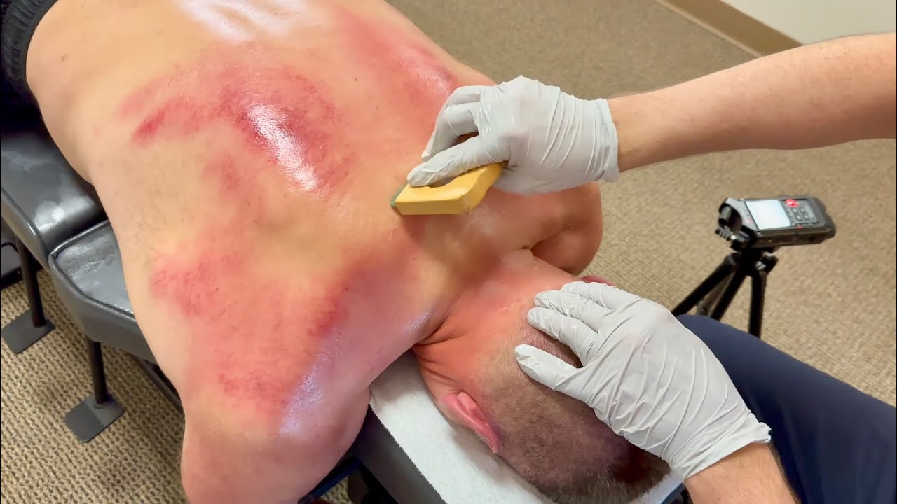 MEGA RED SHOULDER GET RID OF SCAR TISSUE