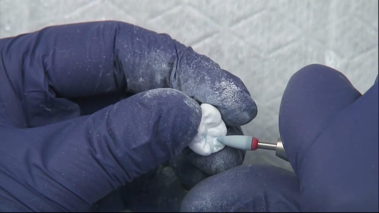 Zirconia 101: 6 of 11: Finishing zirconia pre-polish