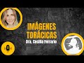 Imágenes Torácicas Podcast: Aprendé Radiología en Equipo, Fácil y Aplicado