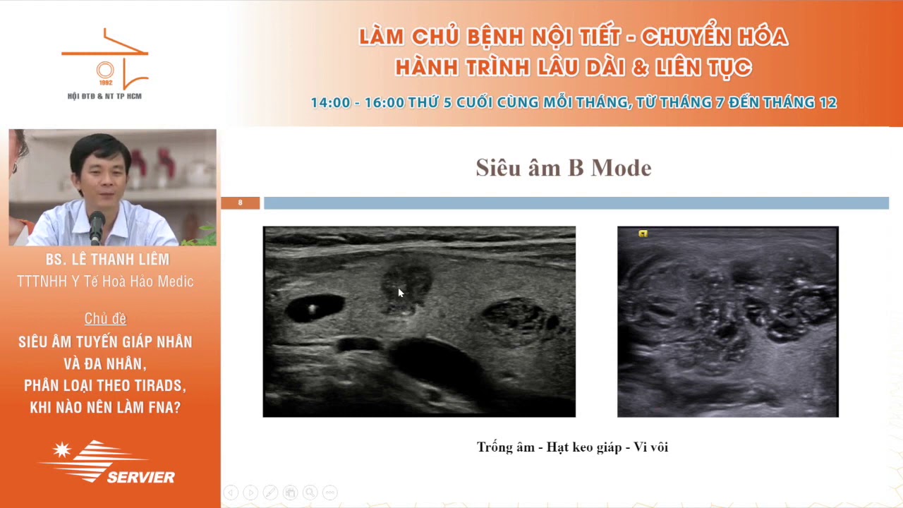 SIÊU ÂM CHẨN ĐOÁN BƯỚU GIÁP NHÂN | PHÂN LOẠI THEO TIRADS | CHỈ ĐỊNH ...
