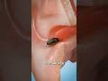 What to do if a fly gets into your ear#shorts #youtubeshorts #shortsvideo #viralvideo