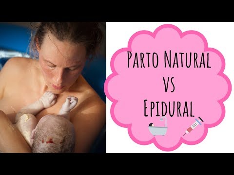 PARTO NATURAL  o con EPIDURAL 💉. Pros y contras.