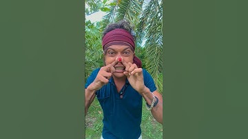 How I Cured a Bug Bite with Yogurt in the Wild | Survival Hacks #1589187