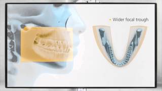 Henry Schein UK - CS 8100 from Carestream Dental