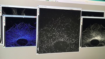 TIRF and STORM Demonstration