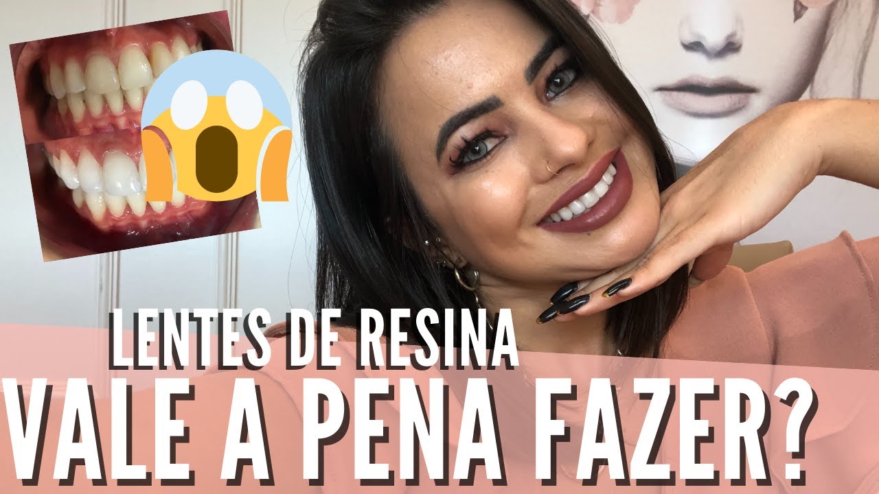 PORQUE LENTES DE RESINA AO INVÉS DE PORCELANA?