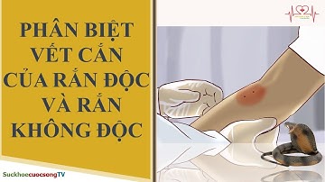 Phân biệt vết cắn của rắn độc và rắn không độc - SuckhoecuocsongTV