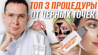 Топ 3 средства от ЧЕРНЫХ ТОЧЕК в домашних условиях #черныеточки