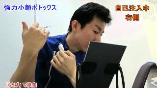 エラボトックスの効果的な打ち方や副作用 失敗について徹底解説 東京新宿の美容整形ならもとび美容外科クリニック