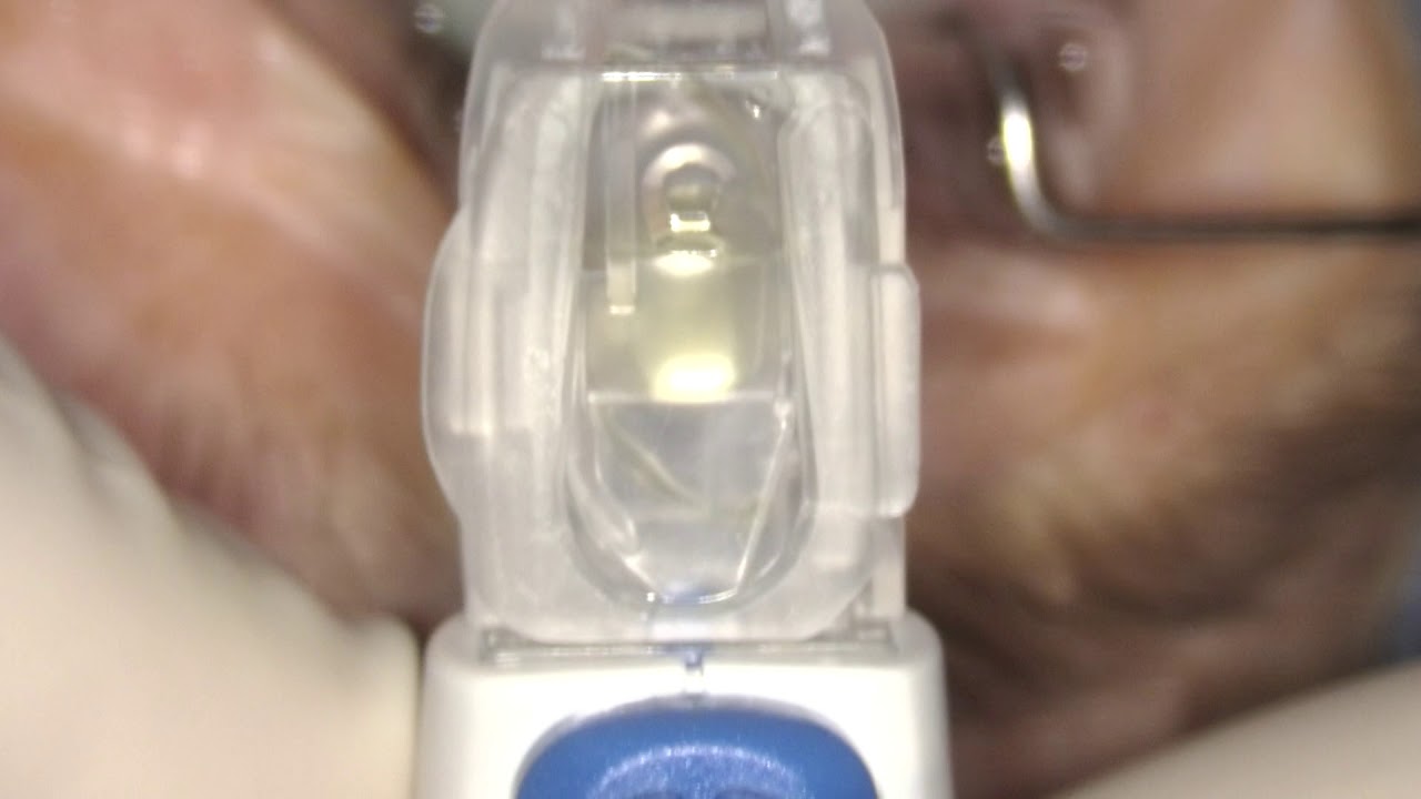 Alcon Clareon AutonoMe IOL Implantation Assos. Prof Levent AKÇAY - YouTube