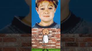 Galiba Halilişko Ailesinin Hastalığını Buldum.bunun Pycnodysostosis...