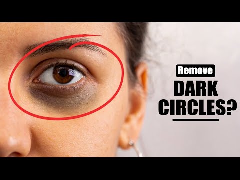 How to remove Dark Circles, Eye bags, Eye wrinkles | Photoshop Tutorial for beginners