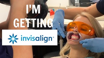 IM GETTING INVISALIGN! PART 1 - 3D SCAN | Kristina Juliett