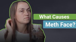 What Causes Meth Face? Resimi