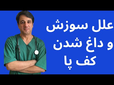 داغی کف پا و سوزش کف پا (بررسی تمام علل احتمالی) - با زیرنویس فارسی