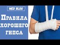 Правильно ли наложен гипс? | Боль и отек и онемение при ношении гипса |  Когда гипс нужно поменять?