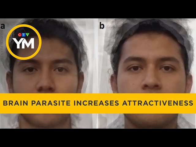 Brain parasite makes people appear more attractive