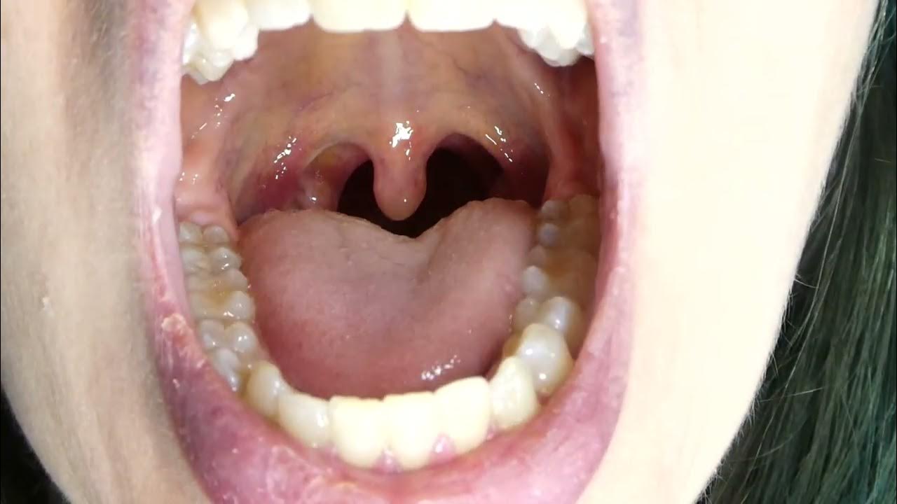 am-i-sick-sore-throat-mouth-tour-teeth-tongue-tonsils-youtube