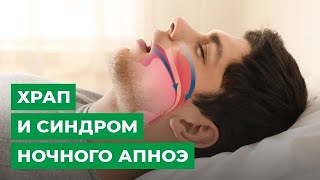 Храп и синдром ночного апноэ