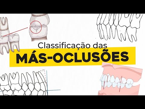 Vídeo: Quem desenvolve a teoria da oclusão normal?